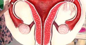 Фото: Симптомы и лечение аднексита